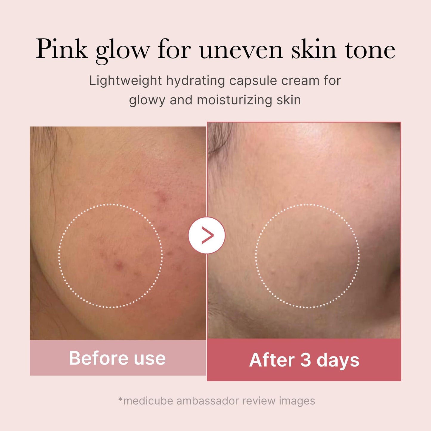 Medicube Capsule Cream with Deep Vitamin C Crema con Cápsulas de Vitamina C, Luminosidad y Piel de Aspecto Más Uniforme, Textura Gel Hidratante, Cosmética Coreana, 55 g