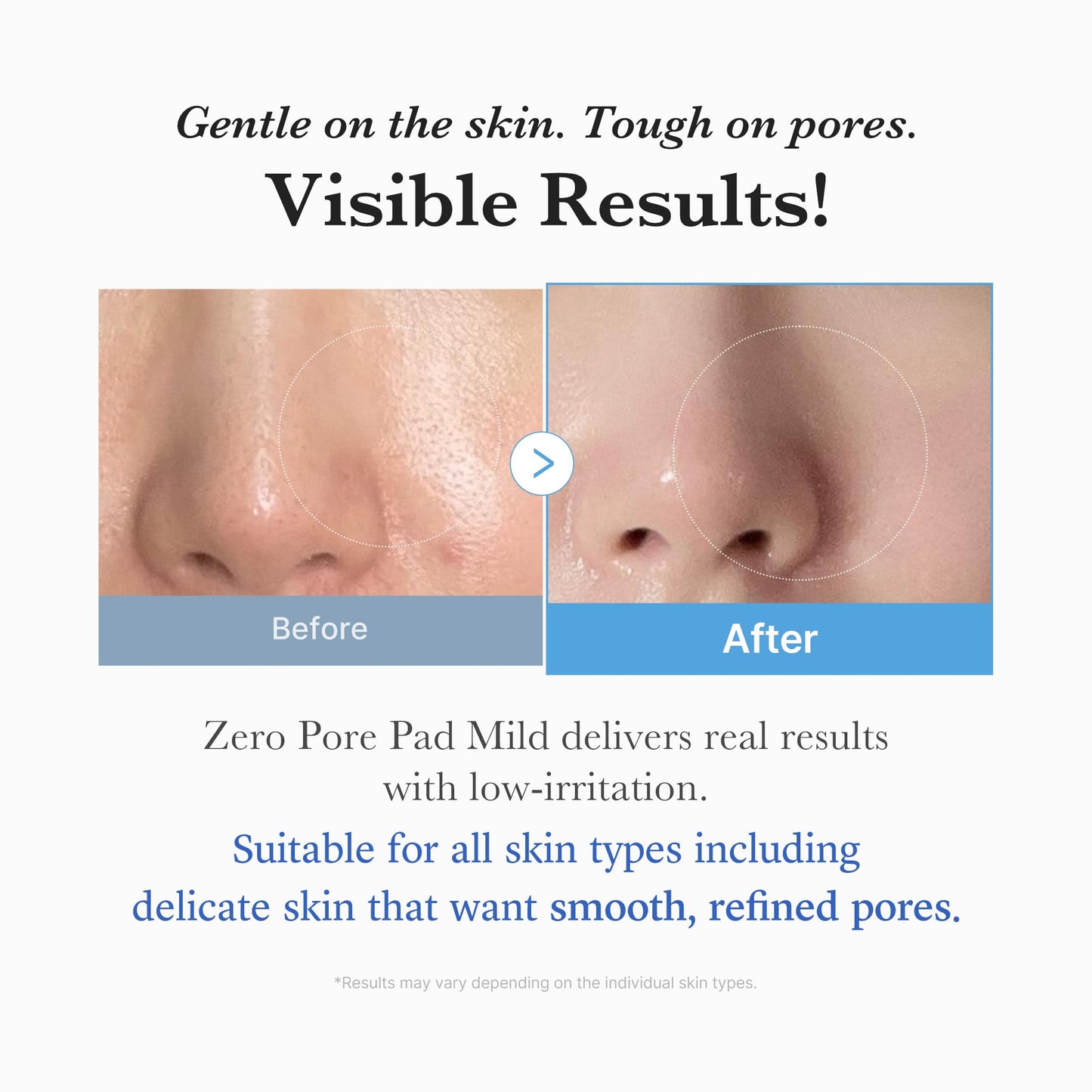 medicube Toner Pads Zero Pore Pad 2.0